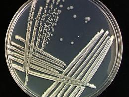 Культивирование Bacillus subtilis