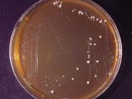 Изучение бактериоцинсинтезирующих свойств пробиотических штаммов