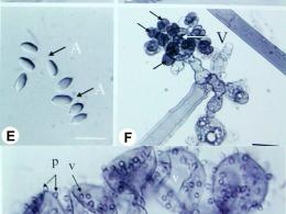 Blakeslea trispora — физиология развития гриба